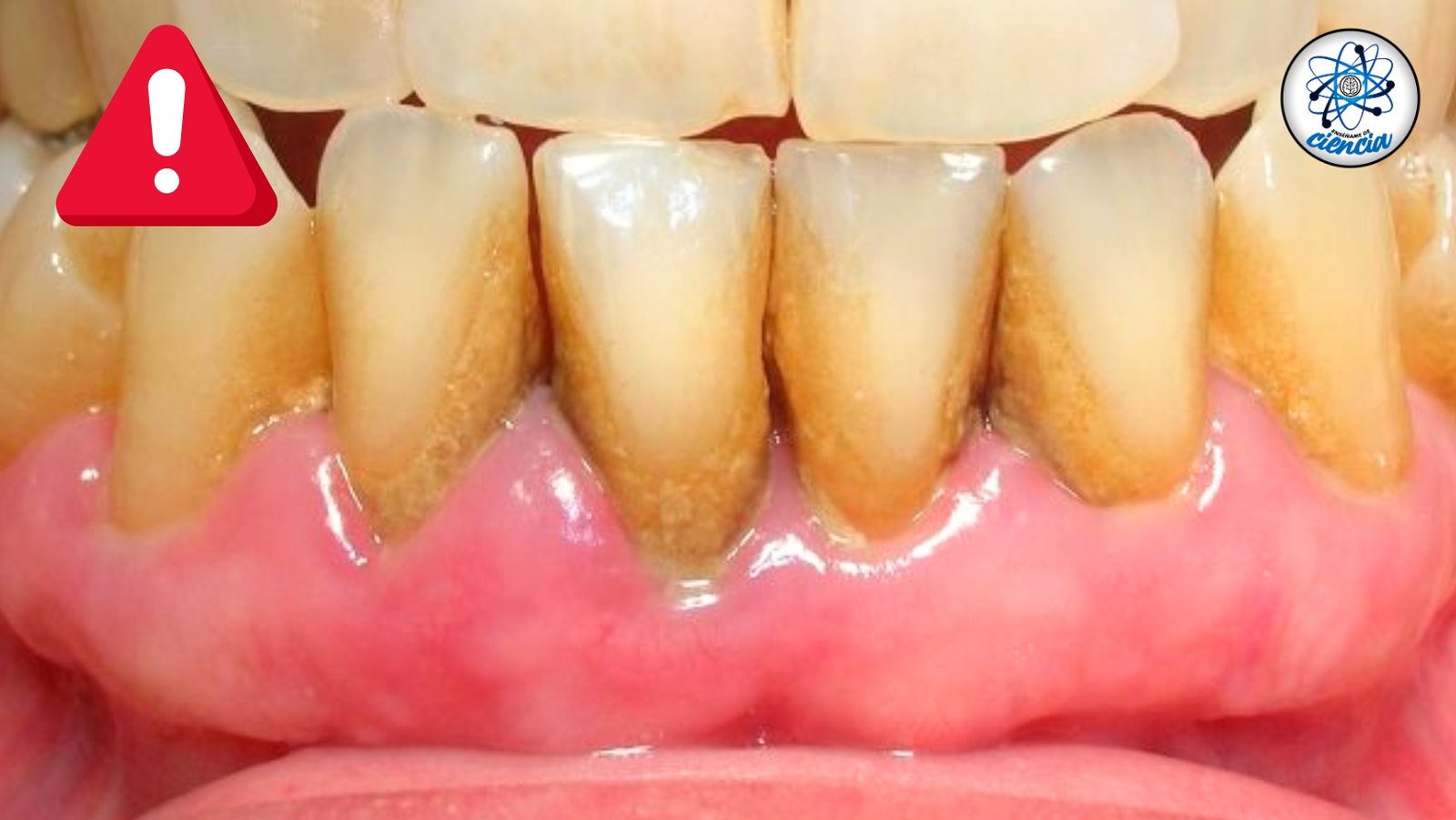 ¡adiós Al Sarro Descubre La Importancia De La Higiene Bucal Para Una Sonrisa Radiante 7416