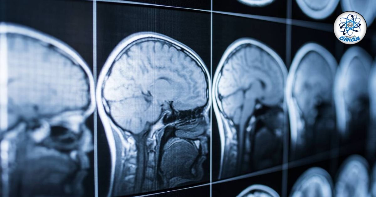 noticiaspuertosantacruz.com.ar - Imagen extraida de: https://ensedeciencia.com/2024/08/27/reciente-estudio-demuestra-que-cada-4000-nacimientos-el-cerebro-muta-de-una-forma-extrana/