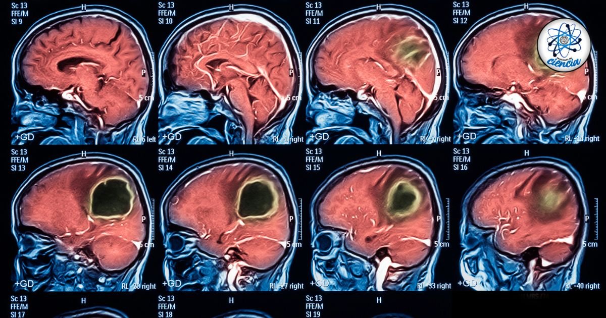 noticiaspuertosantacruz.com.ar - Imagen extraida de: https://ensedeciencia.com/2024/09/03/descubierta-la-reserva-cerebral-capaz-de-prevenir-el-envejecimiento-prematuro-y-la-demencia/