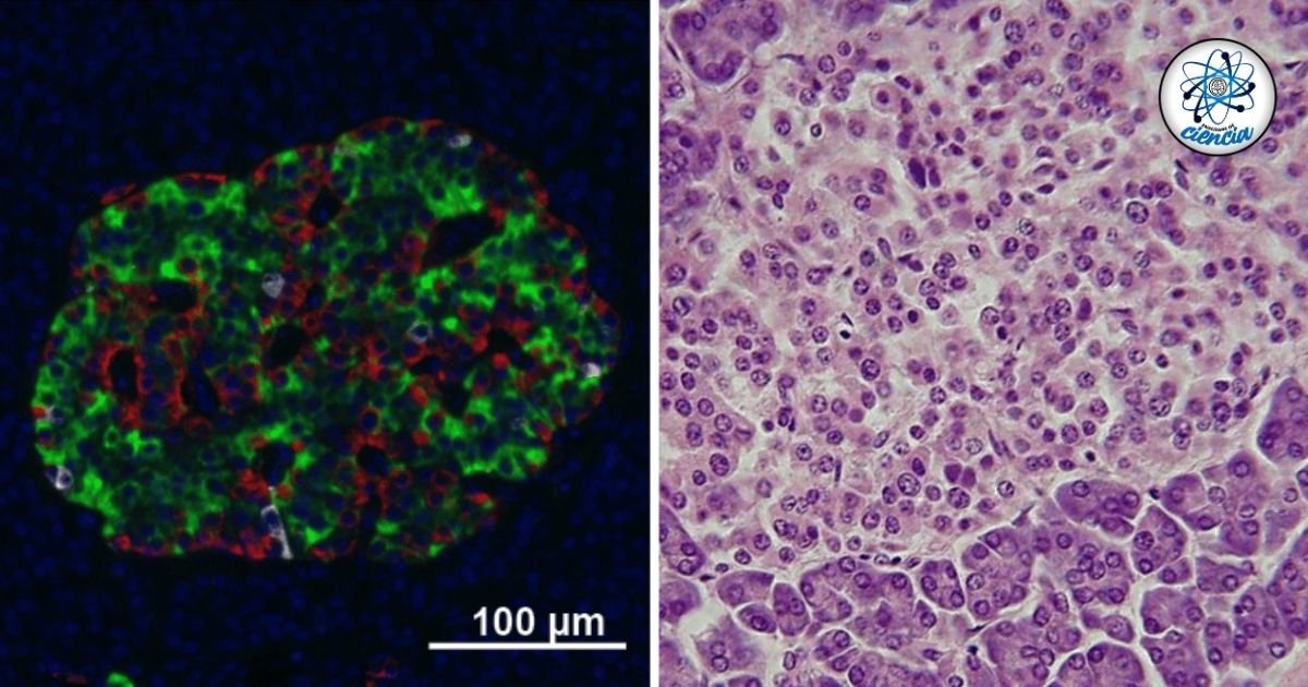 Científicos chinos logran cura para la diabetes tipo 1 con revolucionario tratamiento