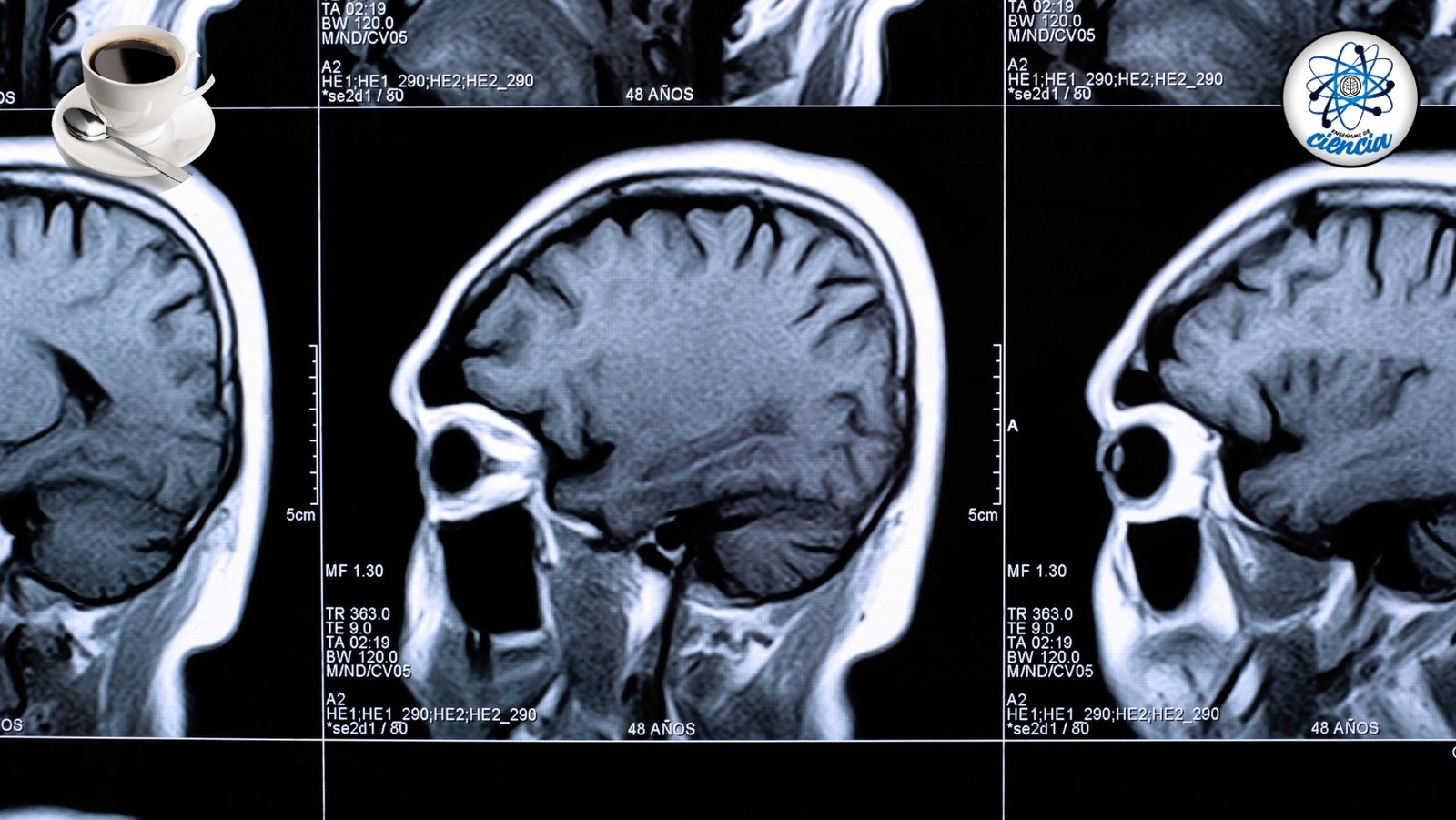 noticiaspuertosantacruz.com.ar - Imagen extraida de: https://ensedeciencia.com/2024/09/24/reconocido-neurologo-revela-los-ingredientes-para-mejorar-tu-cafe-y-tu-memoria/