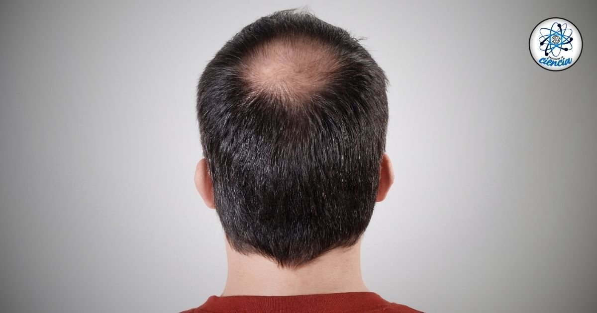 noticiaspuertosantacruz.com.ar - Imagen extraida de: https://ensedeciencia.com/2024/10/03/cual-es-la-forma-correcta-de-tomar-esta-vitamina-para-evitar-la-alopecia/