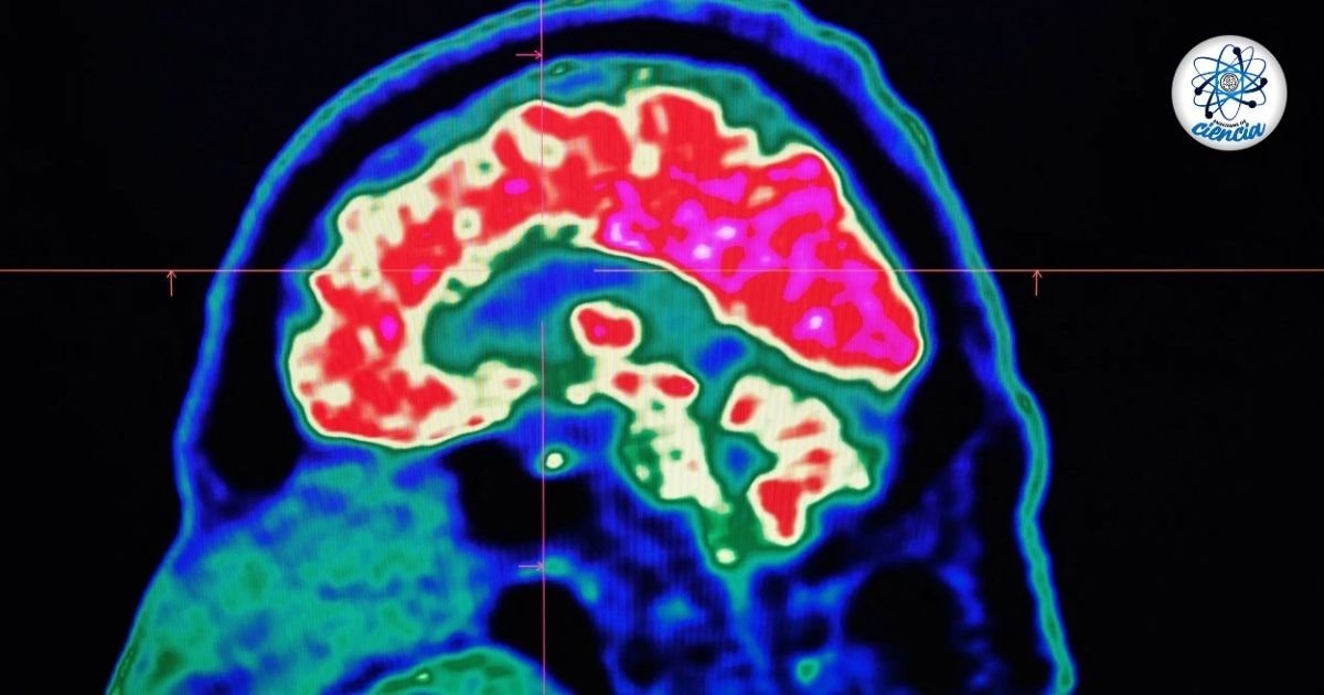 noticiaspuertosantacruz.com.ar - Imagen extraida de: https://ensedeciencia.com/2024/10/09/esta-mujer-jugo-con-su-propio-cerebro-y-al-ver-sus-tomografias-no-pudo-creer-lo-que-descubrio/