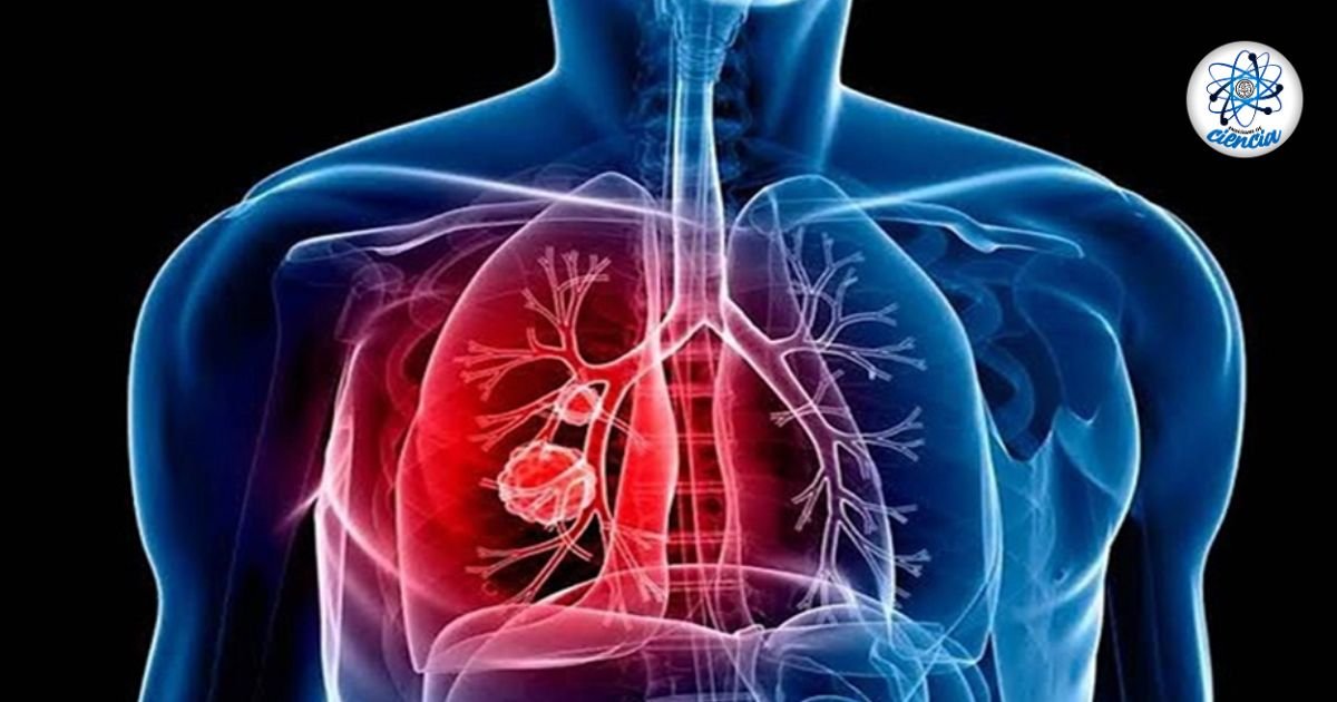 Cáncer de pulmón en no fumadores: la contaminación ambiental, un factor alarmante