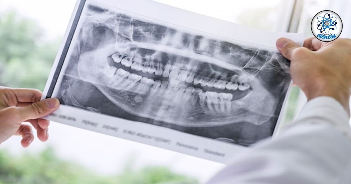 Los daños en los dientes por no beber agua: Consecuencias para la salud dental